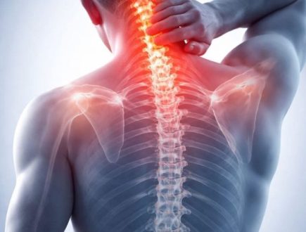 Dolor cervical