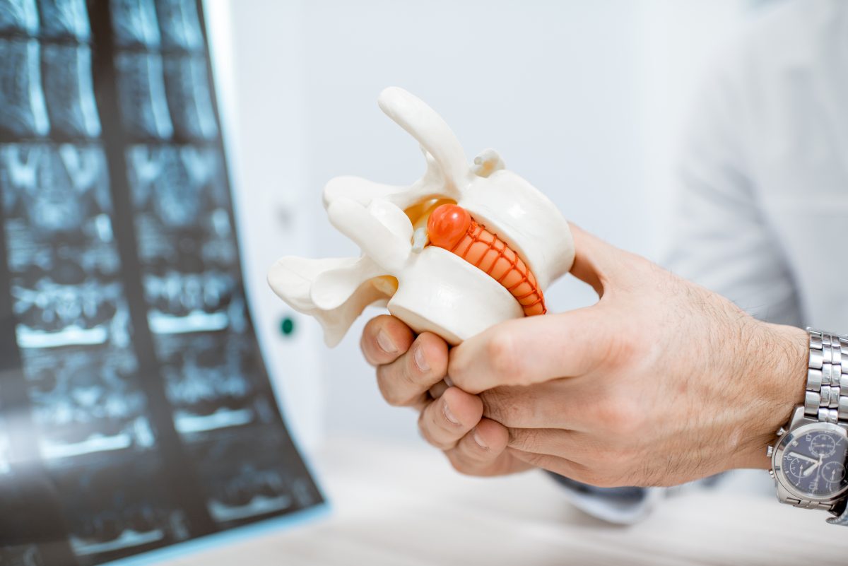 Hernia Discal Lumbar: Diagnóstico Funcional y Rehabilitación Basada en Evidencia