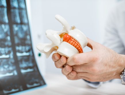 Hernia Discal Lumbar: Diagnóstico Funcional y Rehabilitación Basada en Evidencia