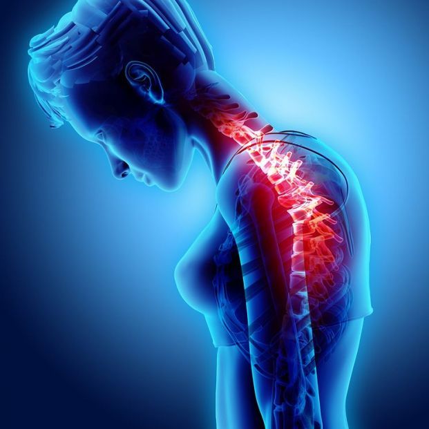 Hipercifosis Dorsal y Alteraciones Posturales: Evaluación y Reeducación Postural