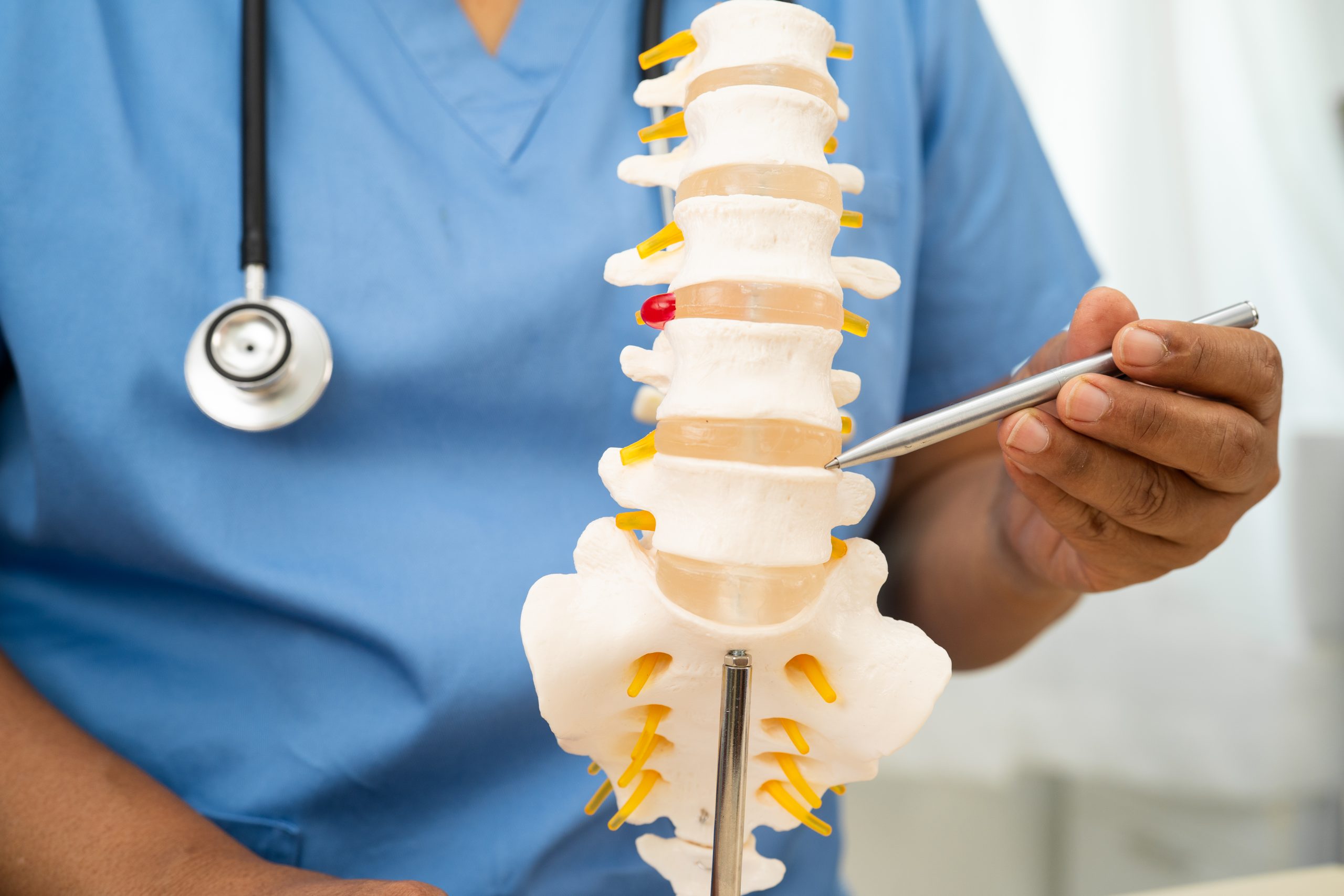 Radiculopatía Lumbar y Dolor Neuropático: Evaluación y Manejo Terapéutico