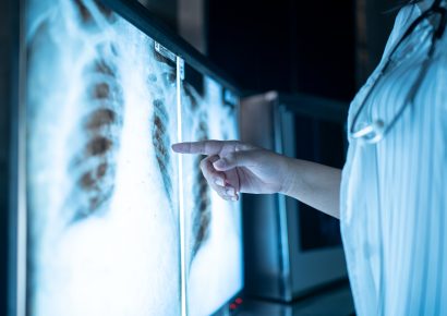 Interpretación Básica de Radiografías y Resonancias Magnéticas para Fisioterapeutas