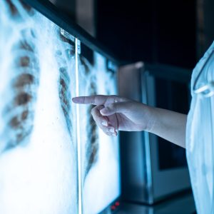 Interpretación Básica de Radiografías y Resonancias Magnéticas para Fisioterapeutas
