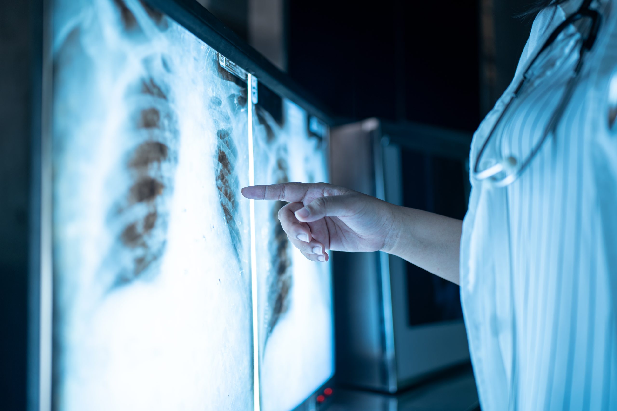 Interpretación Básica de Radiografías y Resonancias Magnéticas para Fisioterapeutas