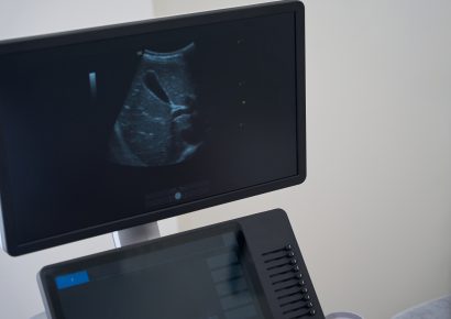 Ecografía Básica para Fisioterapeutas: Introducción Práctica a la Ecografía Musculoesquelética