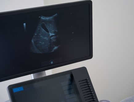 Ecografía Básica para Fisioterapeutas: Introducción Práctica a la Ecografía Musculoesquelética
