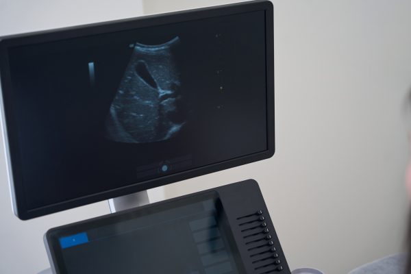 Ecografía Básica para Fisioterapeutas: Introducción Práctica a la Ecografía Musculoesquelética
