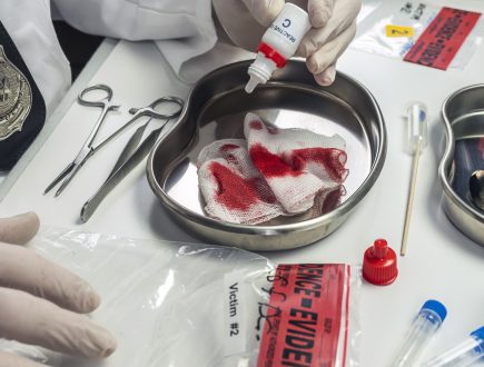 Actuación ante Hemorragias y Shock: Protocolos de Emergencia